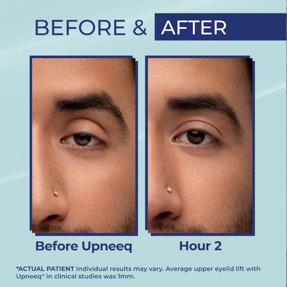 UPNEEQ Eye Drops