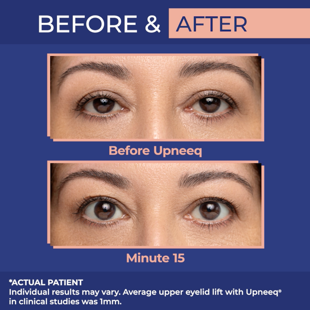 UPNEEQ Eye Drops